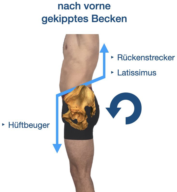 Hohlkreuz endgültig wegtrainieren mit 7 Übungen - funcFIT